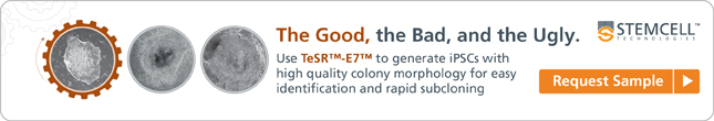Use TeSR-E7 to generate iPS cells with high quality colony morphology for easy identification and rapid subcloning. Request your sample.